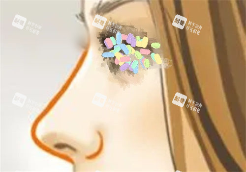 鼻部侧面曲线展示图 鼻部侧面曲线展示图