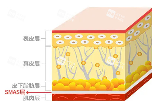 皮肤筋膜层卡通示意图 皮肤筋膜层卡通示意图