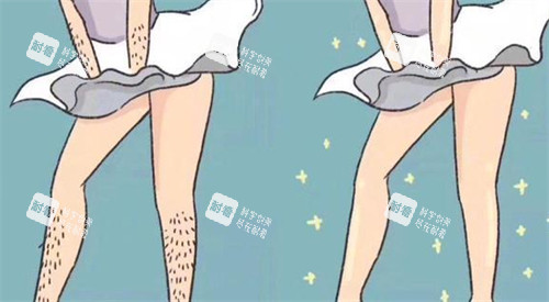 脱毛前后对比图 脱毛前后对比图