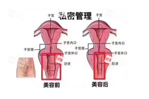 子宫概念图