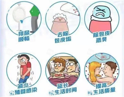 割包皮的好处 割包皮的好处