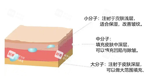 注射层次