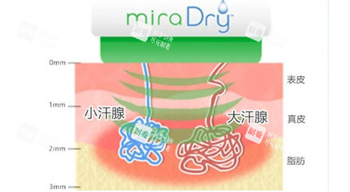 清新微波治疗原理