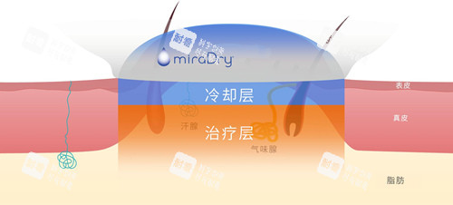 清新微波