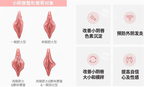 韩国信所爱女性医院小阴唇整形.jpg 韩国信所爱女性医院小阴唇整形.jpg