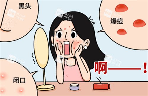 闭口问题 闭口问题