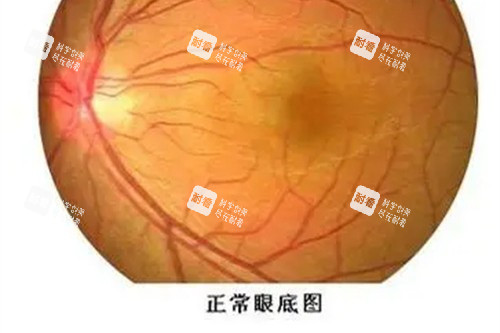 近视眼手术宣传图