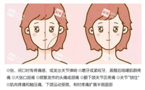 颞下颌关节紊乱出现的大小脸