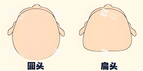 头部填充术前手术上方对比动画图