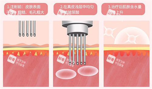水光作用对比
