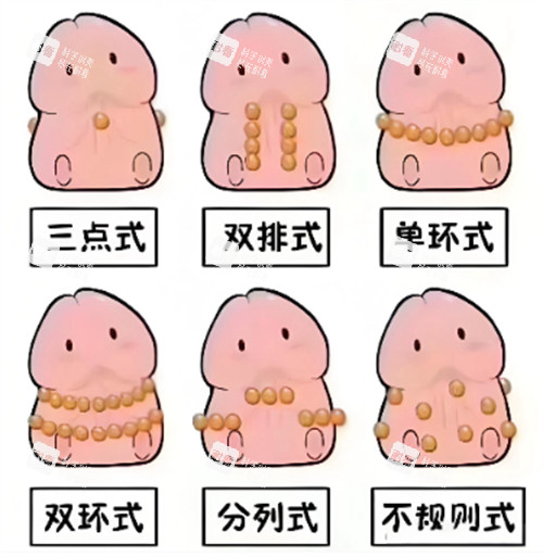 入珠的不同方式 入珠的不同方式