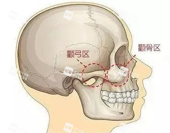 颧骨部位图 颧骨部位图