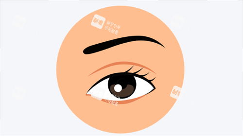 单眼皮展示.png