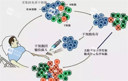 注射干细胞.jpg 注射干细胞.jpg