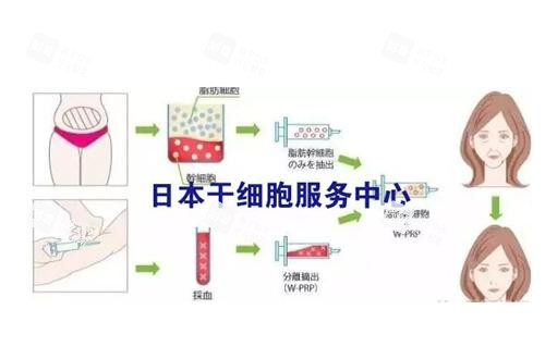 日本干细胞服务流程.png 日本干细胞服务流程.png