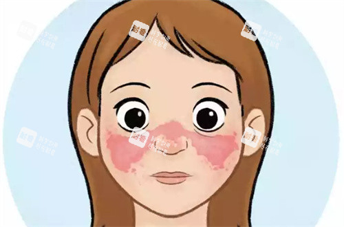鲜红斑痣.jpg 鲜红斑痣.jpg