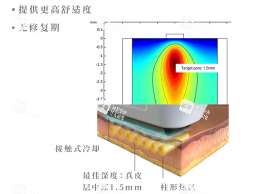 softwave索夫波功效.jpg softwave索夫波功效.jpg