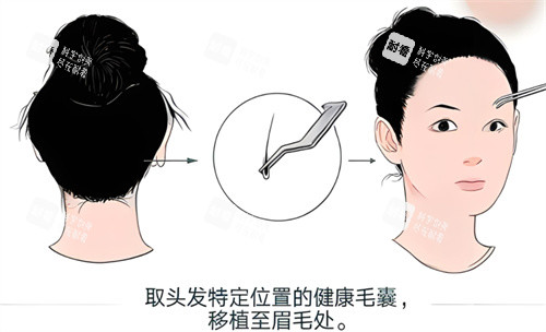 植眉原理图