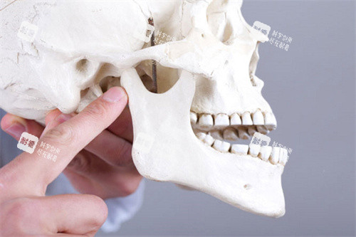 下颌骨错位模型.jpg 下颌骨错位模型.jpg