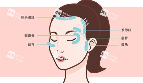 面部提升区域 面部提升区域