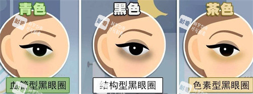 不同的黑眼圈类型