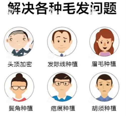 潍坊建中植发可解决问题