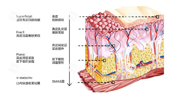 欧洲之星fotona4d皮肤层级照片.jpg