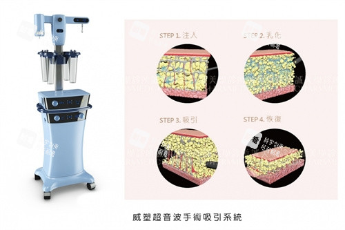 威塑手术机器与手术方式演示图.jpg 威塑手术机器与手术方式演示图.jpg
