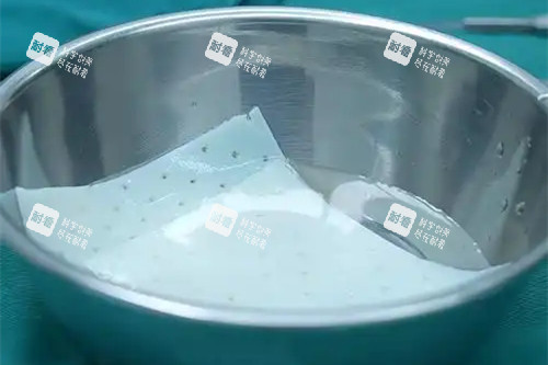 生物补片取出后能回归原状吗：脱细胞补片可自行降解吸收，多数无需取出，即使取出改善理想
