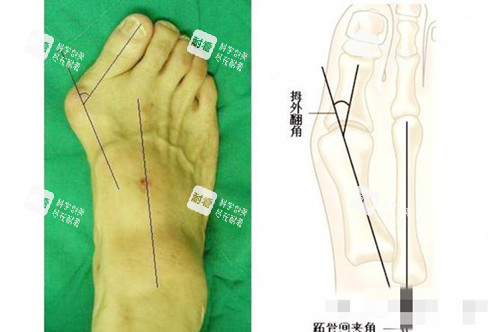 大脚骨对比.jpg 大脚骨对比.jpg