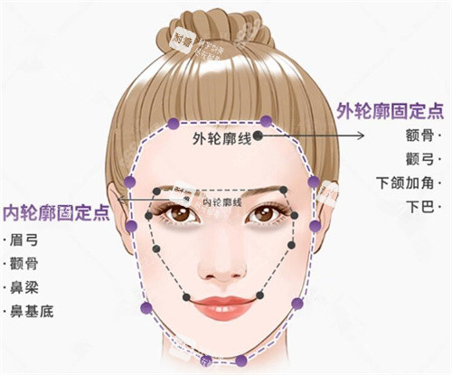 轮廓固定图示.jpg 轮廓固定图示.jpg