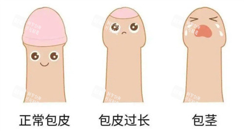正常包皮和包皮过长 正常包皮和包皮过长
