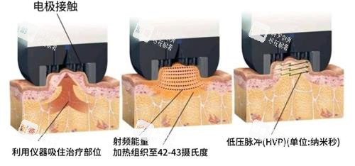 钻石超塑的原理.jpeg 钻石超塑的原理.jpeg