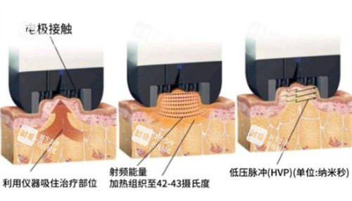 钻石超塑的原理图解.jpg 钻石超塑的原理图解.jpg