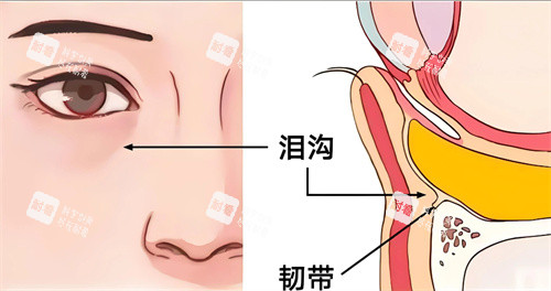 泪沟填充卡通图.jpg