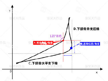 北京圣嘉新医疗美容医院张笑天下颌角手术设计.jpg 北京圣嘉新医疗美容医院张笑天下颌角手术设计.jpg