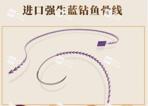 美国强生鱼骨线.jpg 美国强生鱼骨线.jpg
