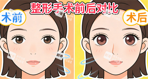 双眼皮前后.jpg 双眼皮前后.jpg