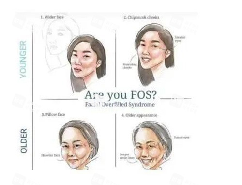 馒化脸示意图.jpg 馒化脸示意图.jpg