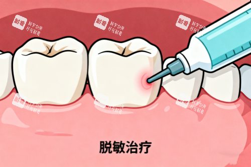 牙齿敏感治疗卡通图.png 牙齿敏感治疗卡通图.png