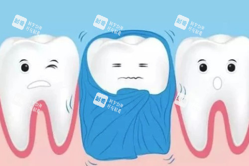 牙齿敏感卡通图片展示.jpg 牙齿敏感卡通图片展示.jpg