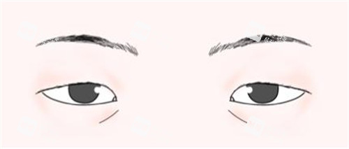 三角眼 三角眼