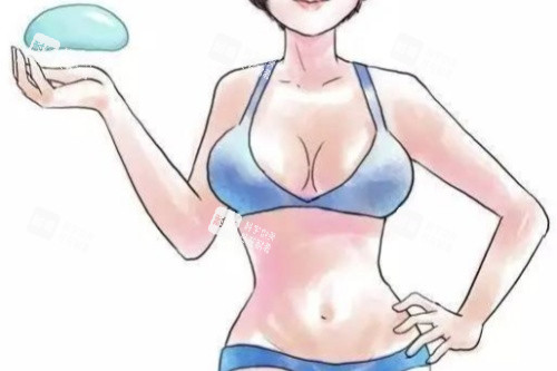 假体丰胸卡通图 假体丰胸卡通图