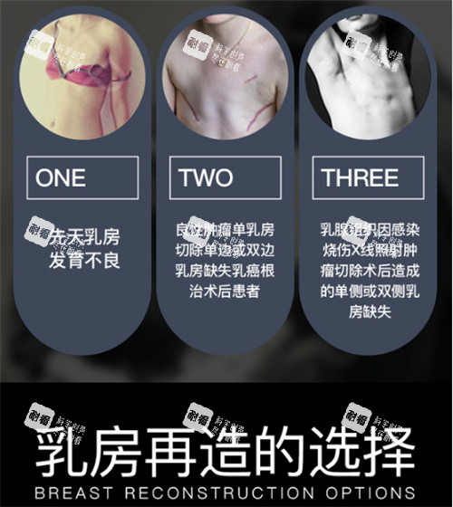 乳房再造适应症.jpg 乳房再造适应症.jpg
