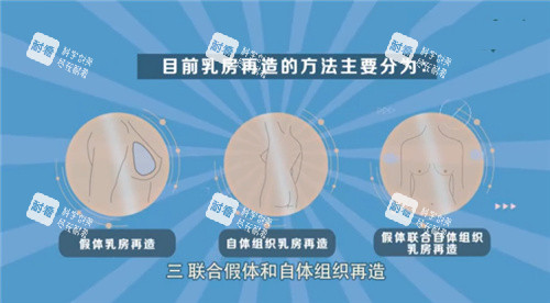 乳房再造手术方式.jpg 乳房再造手术方式.jpg