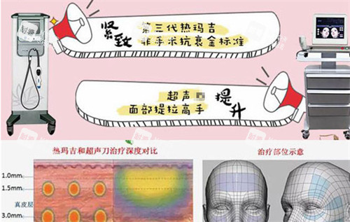 热玛吉与超声仪器抗衰的作用图解.jpg 热玛吉与超声仪器抗衰的作用图解.jpg