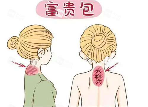 富贵包位置图示 富贵包位置图示