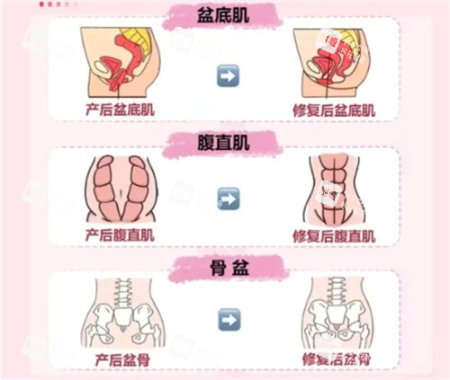 产后修复要做的项目.jpg 产后修复要做的项目.jpg