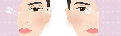 双眼皮失败修复.png 双眼皮失败修复.png