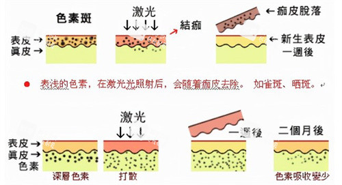 皮秒的原理素材.jpg